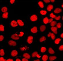 一步法TUNEL细胞凋亡原位检测试剂盒，升级装（红色TRITC标记荧光检测法，通用型）